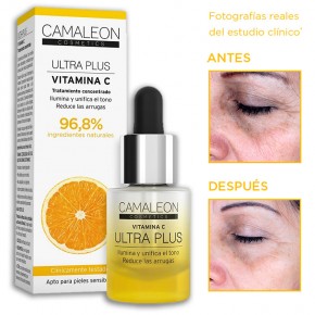 SÉRUM VIT. C ULTRA PLUS CAMALEÓN 15ml.